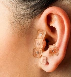 acupuntura-auricular-spazio-corpore