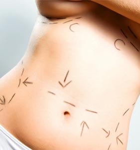 pre-e-pos-operatorio-spazio-corpore
